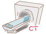 CTの種類