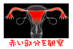 子宮卵管造影の検査内容
