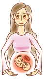 筋腫の妊娠への影響